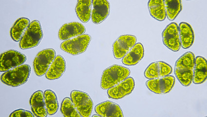 Les micro-algues contre les métaux lourds ? L'avis du naturopathe